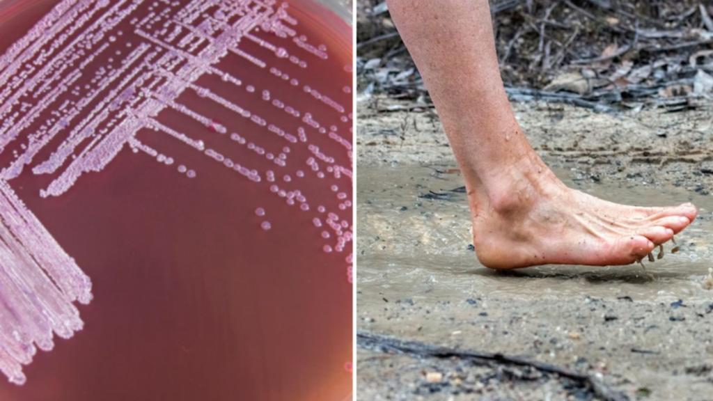 Patient dies of infectious disease