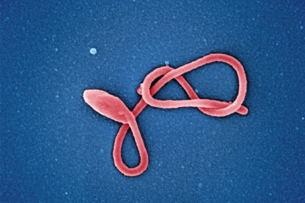 A colourised scanning electron micrograph of a single Ebola virus particle, a red filament looped into knots on a speckled blue background.